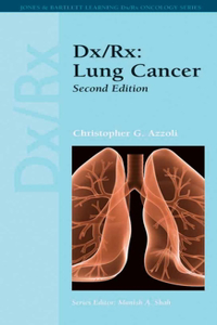 DX/Rx: Lung Cancer