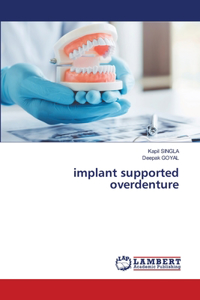 implant supported overdenture