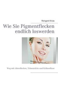 Wie Sie Pigmentflecken Endlich Loswerden