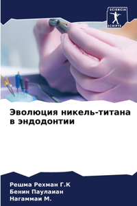 Эволюция никель-титана в эндодонтии