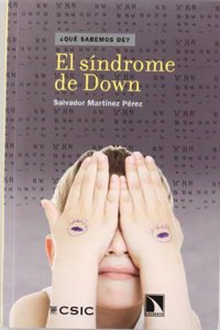 El sindrome de Down