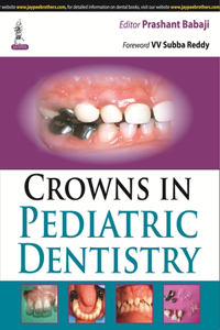 Crowns in Pediatric Dentistry