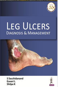 Leg Ulcers