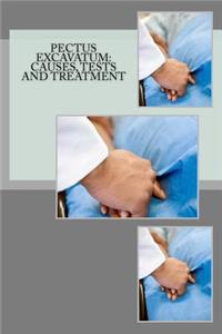 Pectus Excavatum