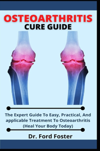 Osteoarthritis Cure Guide