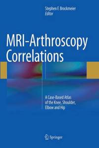 Mri-Arthroscopy Correlations