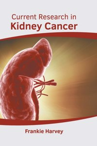 Current Research in Kidney Cancer