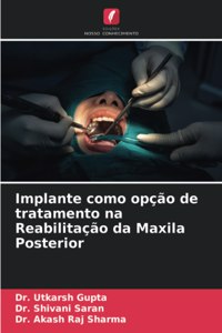 Implante como opção de tratamento na Reabilitação da Maxila Posterior