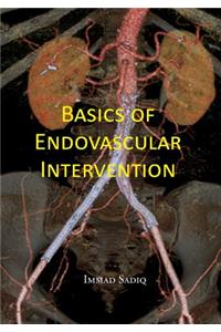 Basics of Endovascular Intervention