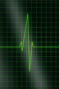 Electrocardiogram - ECG - Keep Yourself Alive Journal