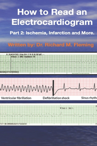 How to Read an Electrocardiogram