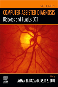 Diabetes and Fundus Oct