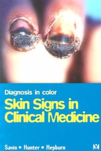 Skin Signs in Clinical Medicine