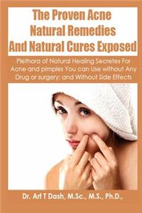 Proven Acne Natural Remedies And Natural Cures Exposed