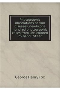 Photographic Illustrations of Skin Diseases, Nearly One Hundred Photographic Cases from Life, Colored by Hand. 2D Ser