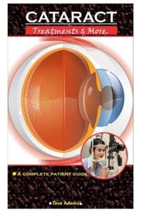 CATARACT. Treatment & More