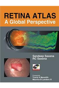 Retina Atlas: A Global Perspective