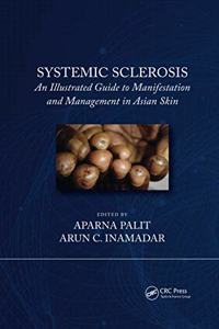 Systemic Sclerosis