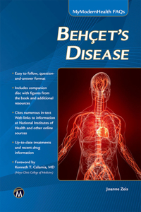 Behcet's Disease