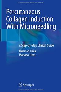 Percutaneous Collagen Induction with Microneedling