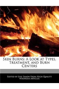Skin Burns