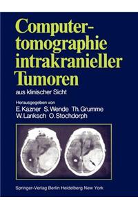 Computertomographie Intrakranieller Tumoren Aus Klinischer Sicht