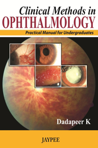 Clinical Methods in Ophthalmology: Practical Manual for Undergraduates