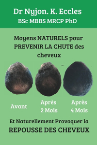 Moyens NATURELS pour Prévenir la chute des cheveux