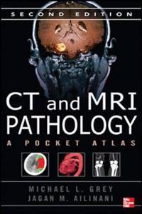 CT & MRI Pathology: A Pocket Atlas, Second Edition (Int'l Ed)