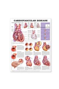 Cardiovascular Disease Anatomical Chart