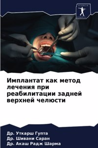 Имплантат как метод лечения при реабилита