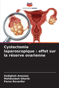 Cystectomie laparoscopique