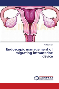 Endoscopic management of migrating intrauterine device
