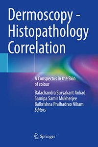 Dermoscopy - Histopathology Correlation