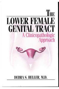 The Lower Female Genital Tract