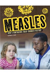 Measles