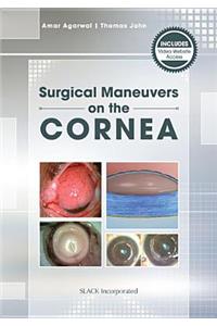 Mastering Corneal Surgery