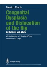 Congenital Dysplasia and Dislocation of the Hip in Children and Adults