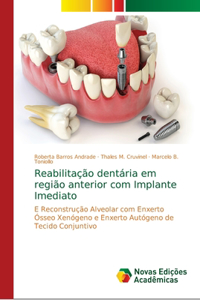 Reabilitação dentária em região anterior com Implante Imediato