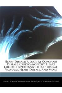 Heart Disease; A Look at Coronary Disease, Cardiomyopathy, Heart Failure, Hypertensive Heart Disease, Valvular Heart Disease, and More