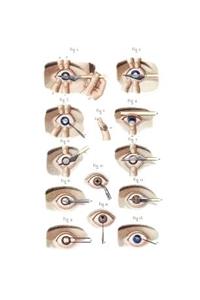 Cataract and Artificial Pupil Composition Notebook