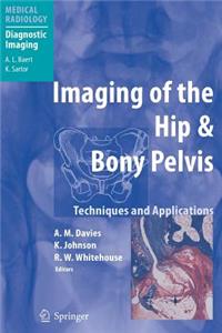 Imaging of the Hip & Bony Pelvis