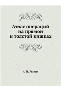 Атлас операций на прямой и толстой кишка
