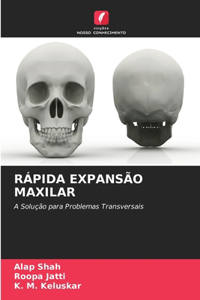 Rápida Expansão Maxilar