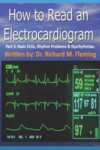 How to Read an Electrocardiogram - Part 3