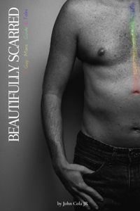 Beautifully Scarred