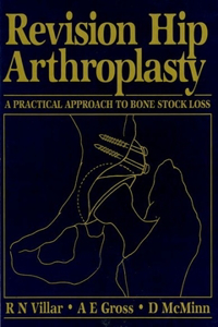 Revision Hip Arthroplasty: A Practical Approach to Bone Stock Loss