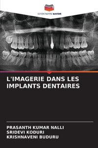 L'Imagerie Dans Les Implants Dentaires