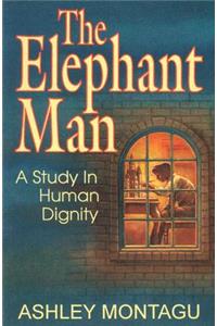 The Elephant Man