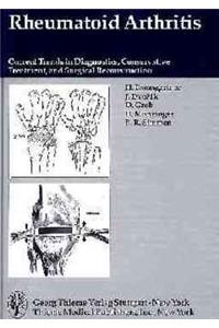 Rheumatoid Arthritis: Current Trends in Diagnostics, Conservative Treatment and Surgical Reconstruction